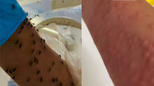 melbourne-researcher-feeds-mosquitoes-with-her-own-blood-internet-reacts