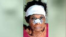 rooster-attack-in-kollam-elderly-woman-attacked