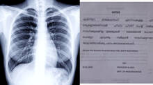 no-x-ray-film-in-kozhikode-medical-college