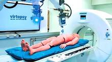 virtual-autopsy