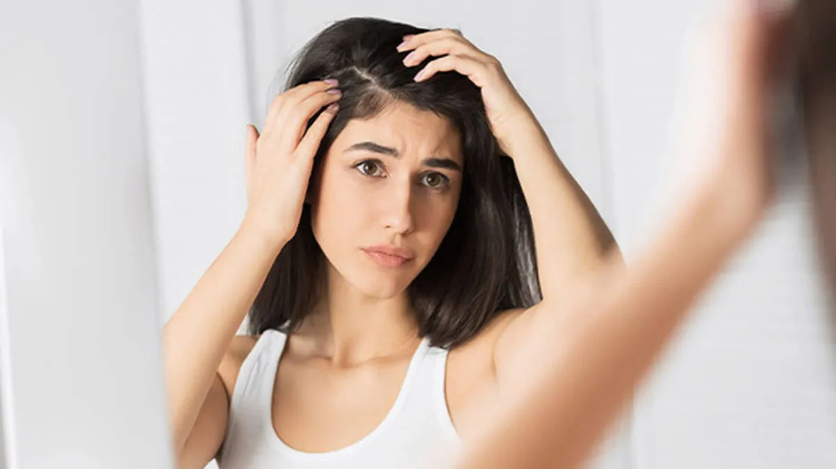 dry-scalp
