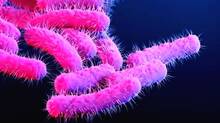 10-more-people--confirmed--shigella-today