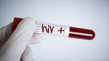 karnataka-hiv-test-for-college-students
