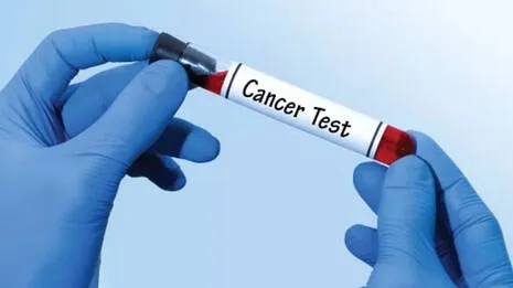 cancer-test.1.3985364