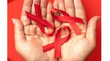 hiv