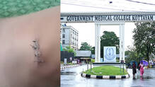 kottayam-medical-college-one-year-old-treatment-negligence