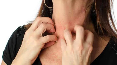 itchy-skin.1.4007091