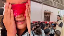 doctor-removed-eyes-school-mobile-awareness