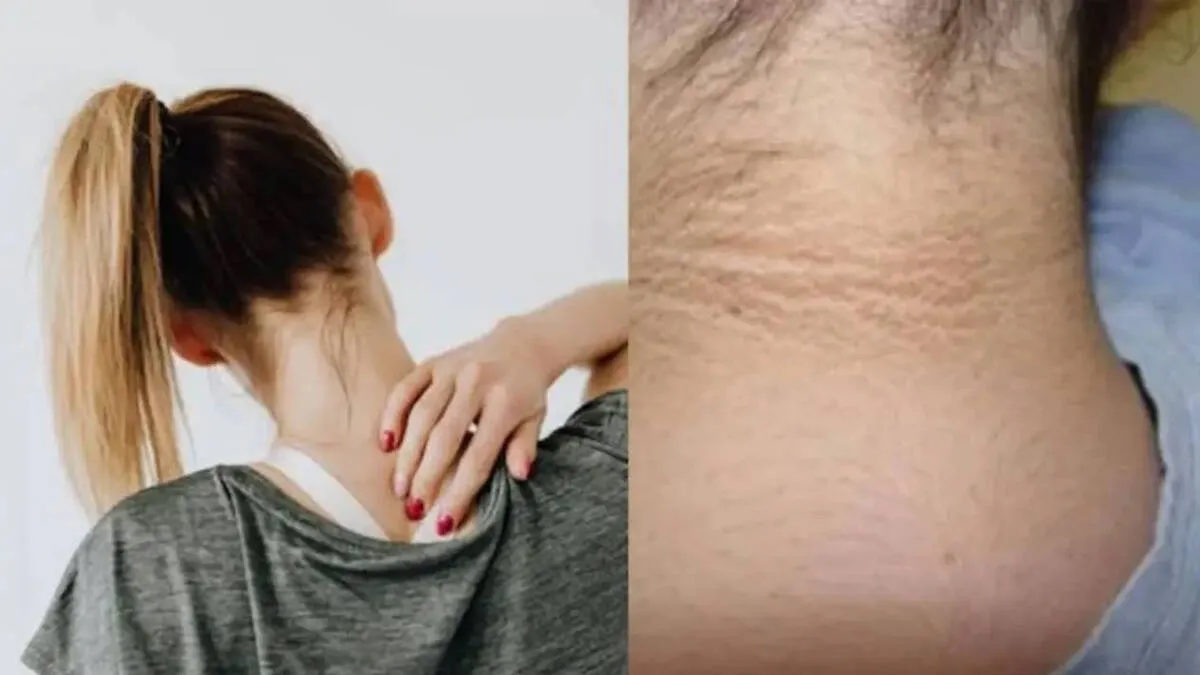 darkl-neck