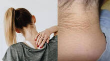 darkl-neck