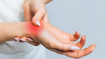 arthritis
