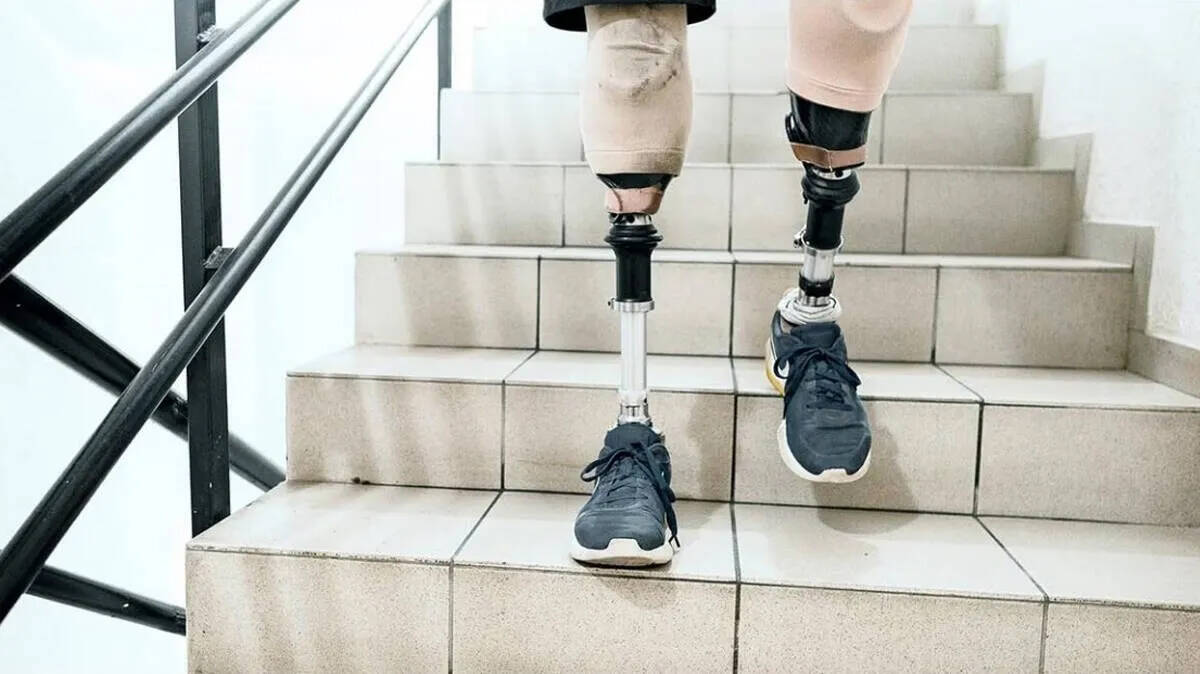 leg