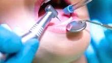pg-dental