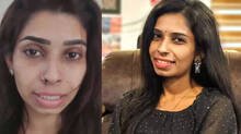 renu-sudhi