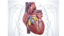 angioplasty-